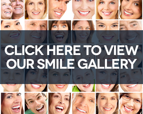 Smile Gallery